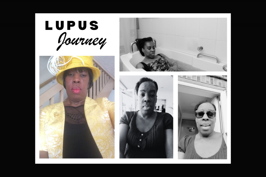 Lupus journey