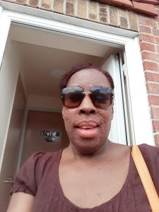 Smiling despite the flares