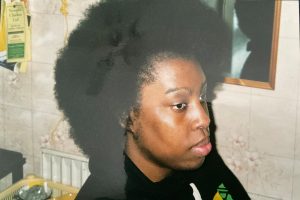 hair after losing most of it 